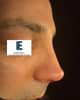 Slider image (6) Dr. Emin Eren Clinic